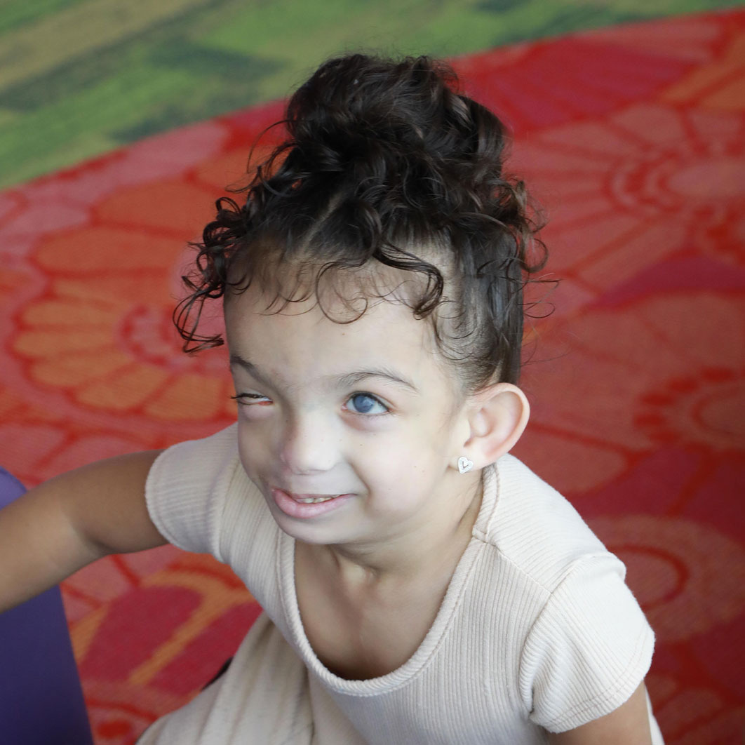 Plastic Surgery patient girl playing